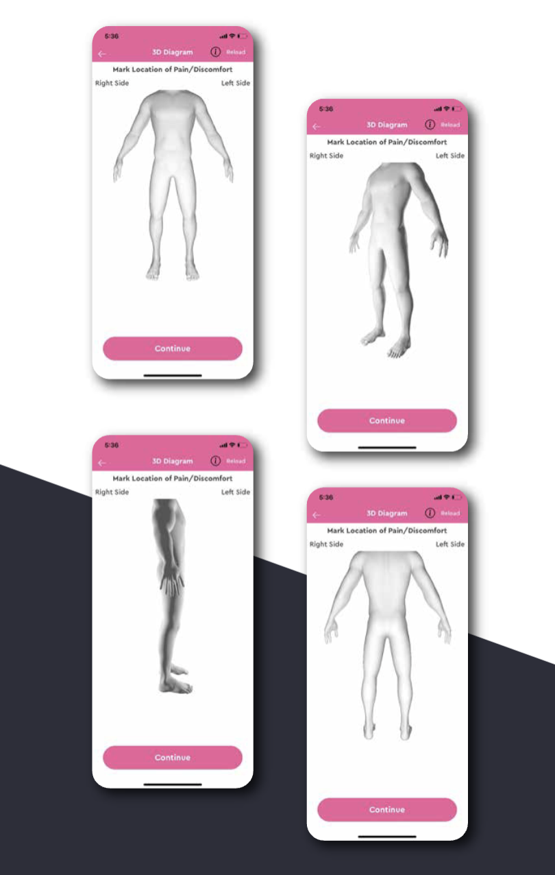 Body Posture Alignment App